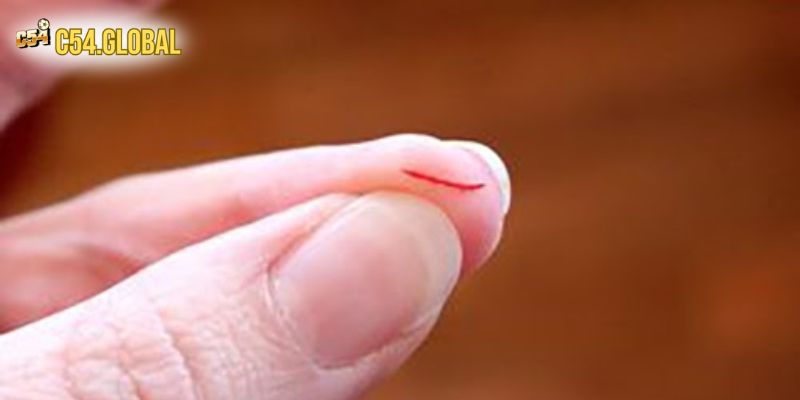 dut tay danh con gi giac mo Về giấc mơ thấy đứt tay