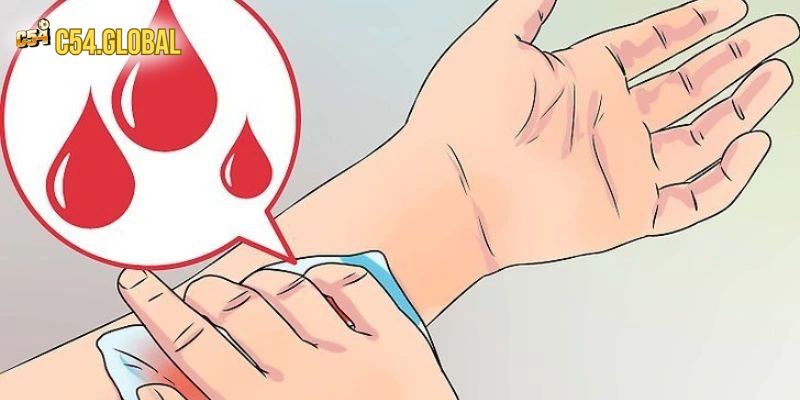 dut tay danh con gi thong tin Mơ đứt tay không chảy máu