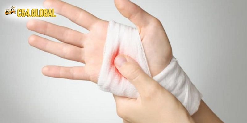Mơ Thấy Đứt Tay Đánh Con Gì Ăn Đậm? Trọn Bộ Số Đẹp Hôm Nay